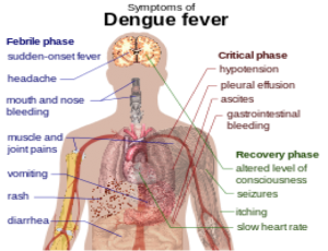 Dengue Holistic Dengue Treatment by Homoeopathy in Navi Mumba